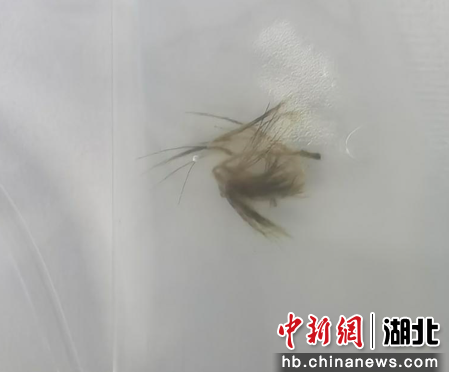 从孩子肺里取出的狗尾巴草毛刺。 郭林 摄